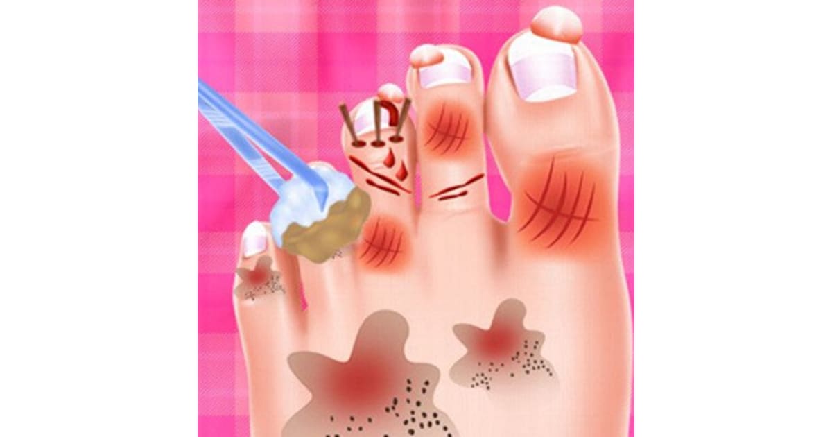 Baby Taylor Foot Treatment Play Now For Free